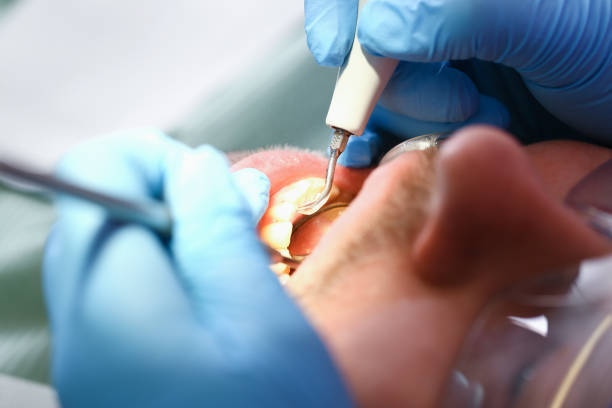 Best Emergency Broken Tooth Repair in Arma, KS