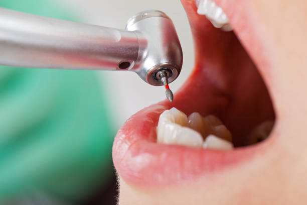 Professional Emergency Dentist in KS